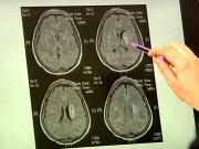 Cerveau Cerveau
