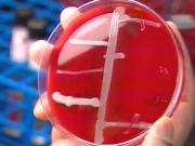 Analyse de laboratoire