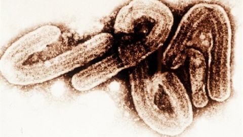Mon image est plus forte que la tienne ! 081105ebola-virus_8