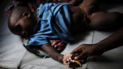 Un enfant atteint de choléra en RDC