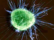 cellules-cancer-seins