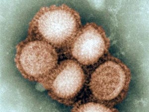Une photo du virus de la grippe A (H1N1)