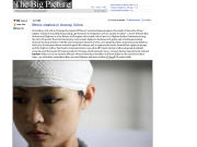 Un patient de l'ethnie han bless� � la t�te