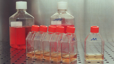 Des flacons contenant des virus dans un laboratoire
