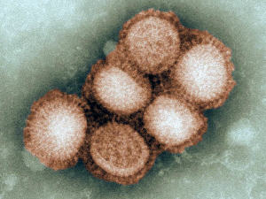 h1n1-grippe