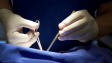 operation-chirurgie