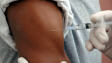 vaccin-bras