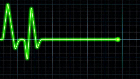 cardiogramme-euthanasie