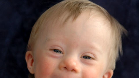 Un enfant trisomique