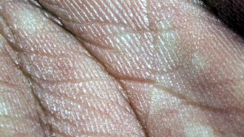 La peau des mains