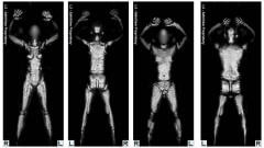 Image de scanner corporel