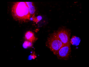Cellules souches placentaires enflammées