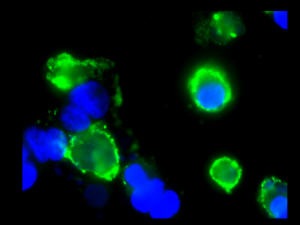 Cellules souches placentaires mortes en raison du BPA