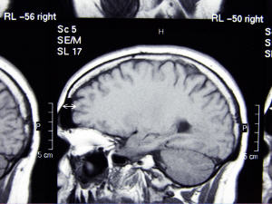 L'image d'un cerveau