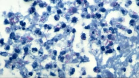 Bact�rie de la tuberculose
