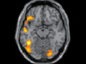 Un cerveau