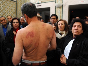 L'avocat Abderrahman Ayedi montre des marques de tortures sur son torse à des activistes des droits humains, le 29 décembre, à Tunis.