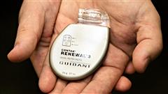 Un stimulateur cardiaque