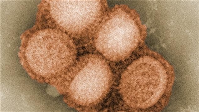 Virus del H1N1 fotografiado en los laboratorios del Centro para el Control de Enfermedades. 