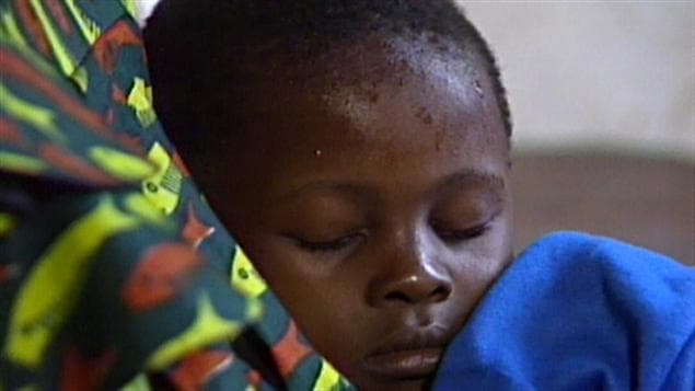 Un enfant atteint de malaria (archives)