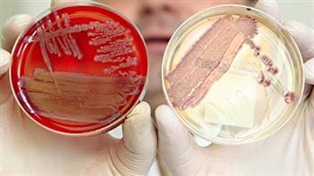 E.coli (archives)