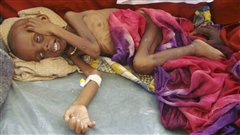 Un enfant souffrant de malnutrition sévère est étendu sur le sol d'un hôpital de Mogadiscio. Ces deux dernières semaines, des milliers de Somaliens ont convergé vers la capitale en raison de la sécheresse.