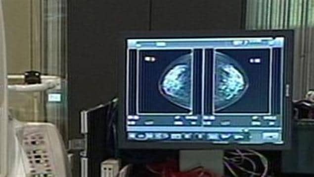 Dépistage du cancer du sein