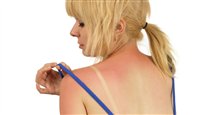 Cancer de la peau : un ennemi en progression