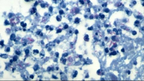 Bactérie de la tuberculose