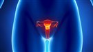 Une pilule pour lutter contre les fibromes