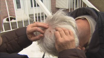 Gérald Côté a été blessé à la tête par le hibou