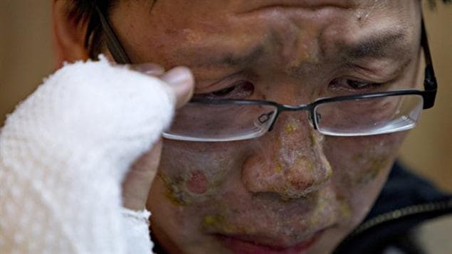 Vinh Nguyen a été blessé lors de l'explosion à Burns Lake