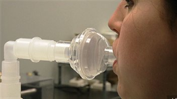 Dépistage du cancer du poumon