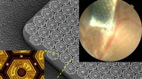 Vers une nouvelle génération d'oeil bionique