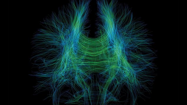Cerveau Cerveau