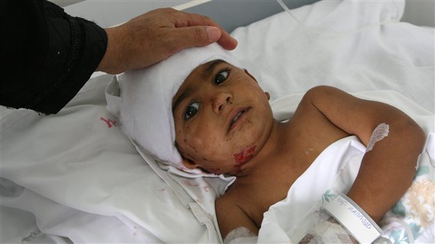 Cet enfant libanais blessé est hospitalisé dans la région nord du Liban près de la frontière syrienne, où les bombardements de l'armée syrienne ont fait cinq morts, samedi, selon des sources hospitalières et les autorités.