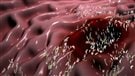 Grand Nord :  taux d'infection élevé à la bactérie H pylori