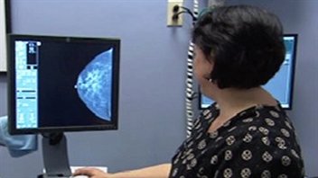 Une mammographie