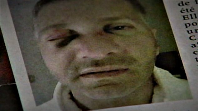 L'homme d'affaires Elio Pagliarulo disait avoir été tabassé en août 2009, alors qu'il circulait en voiture dans Outremont. Une photo de lui, le visage tuméfié, avait été diffusée par le quotidien La Presse.
