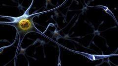 Représentation d'un neurone. Dans l'Alzheimer, les plaques séniles compriment les neurones.