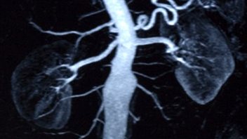 Radiographie des reins