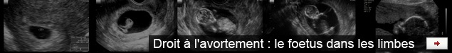 Droit à l'avortement : le foetus dans les limbes