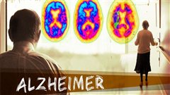 La maladie d'Alzheimer