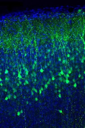 Cette image montre in utero le soma et des dendrites des neurones de la couche supérieure du cortex. En bleu, les noyaux.