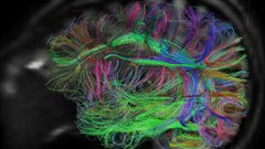 Le d�veloppement c�r�bral 