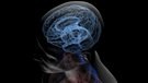 La dysfonction de certaines protéines liée à des malformations au cerveau