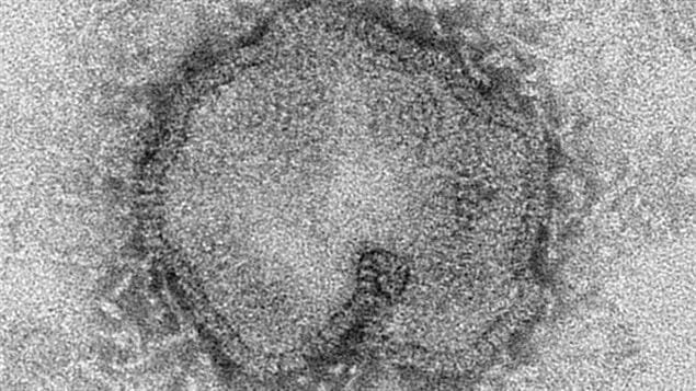 أحد أشكال فيروس إنفلونزا الطيور H7N9