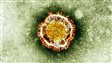 Le coronavirus se transmet sans doute d’homme à homme, selon l’OMS