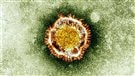 Le coronavirus vu sous un microscope | © Photo AFP