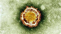 Le coronavirus vu sous un microscope | � Photo AFP